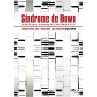 Imagem de Sindrome de down: crescimento, maturacao E atividade fisica