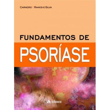 Imagem de Livro - Fundamentos de Psoríase