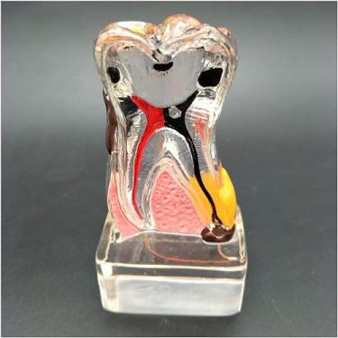 Imagem de Modelo de doença periodontal dentária - Modelo de ensino de estudo de dentes dentários - Modelo de patologia abrangente 4 vezes - Modelo de simulação de dente oral - para estudar ferramenta auxiliar