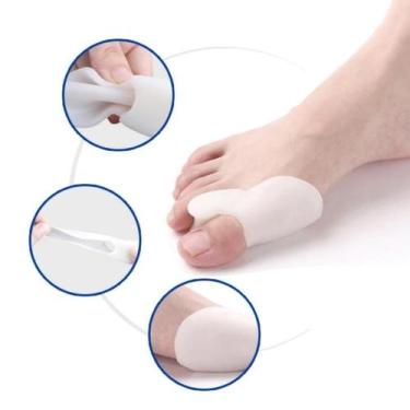 Imagem de Protetor de Joanete em Silicone  Corretor Postural para Pé com Alívio 