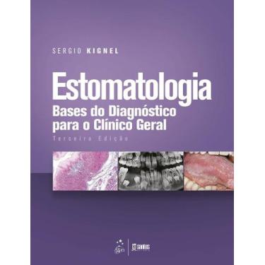 Imagem de Estomatologia - Bases Do Diagnóstico Para O Clínico Geral + Marca Pági