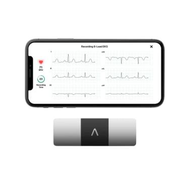 Imagem de OMRON Eletrocardiograma ECG Portátil KardiaMobile 6L