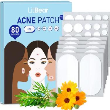 Imagem de Adesivos para Acne e Espinhas LitBear - 80 Unidades com Óleo de Melale