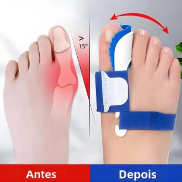 Imagem de Corretor Ortopédico Para Joanete E Hallux Valgus, Tala Noturna Para De