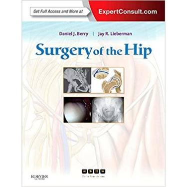 Imagem de Surgery Of The Hip - Expert Consult