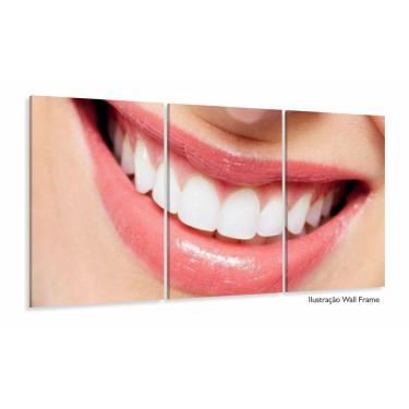 Imagem de Quadro Odontologia Decorativo Consultório Sorriso 120x60 3 p