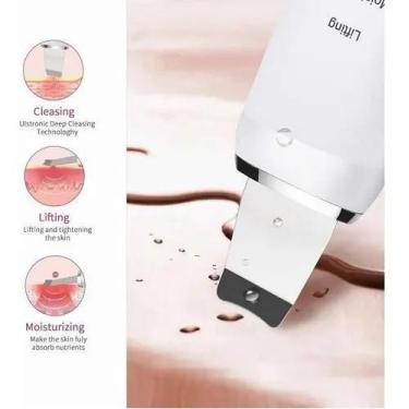 Imagem de Limpeza Facial Peeling Ultrassônico Portátil - Exito