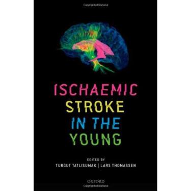 Imagem de Ischaemic Stroke In The Young