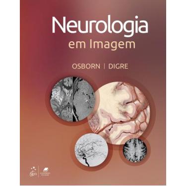 Imagem de Livro - Neurologia Em Imagem