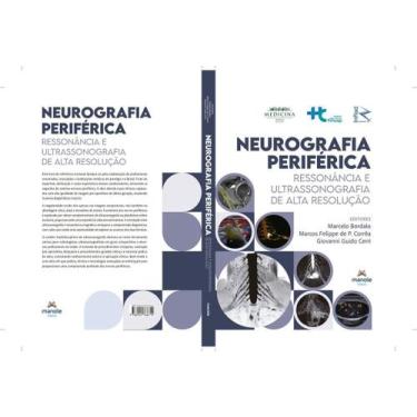 Imagem de Neurografia Periférica - Ressonância e Ultrassonografia de Alta Resolu
