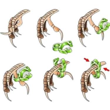 Imagem de Algema Bracelete para Correção de Dedos - Importado