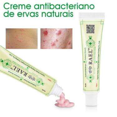Imagem de Pele Creme Creme antibacteriano de ervas naturais Dermatite Eczematóid