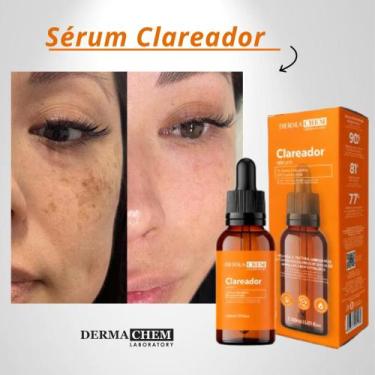 Imagem de Sérum Facial Clareador Dermachem - 30ml