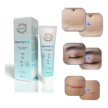Imagem de Pomada Creme para colágeno e Estrias Cicatriz DermaTriz 20g. - Tiarga 