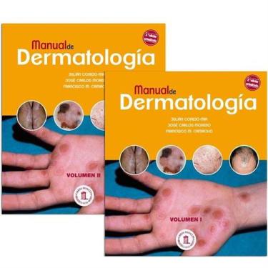 Imagem de Manual De Dermatologia 2 Vols (Espanhol) - Grupo Aula Medica Sl
