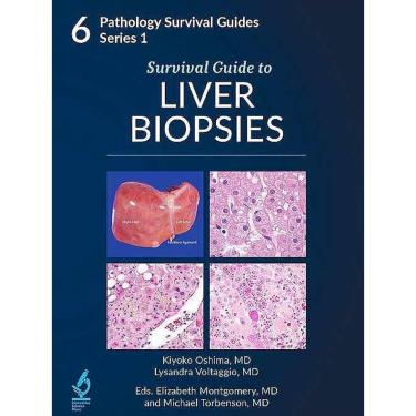 Imagem de Survival Guide To Liver Biopsies