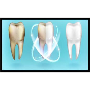 Imagem de Quadro Decorativo Dentista Limpeza Dentes Odontologia Consultórios Sal