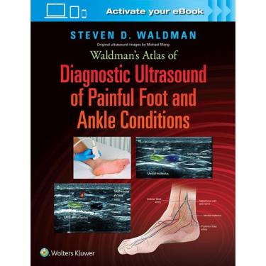 Imagem de Waldmans Atlas Of Diagnostic Ultrasound Of Painful Foot And Ankle Conditio