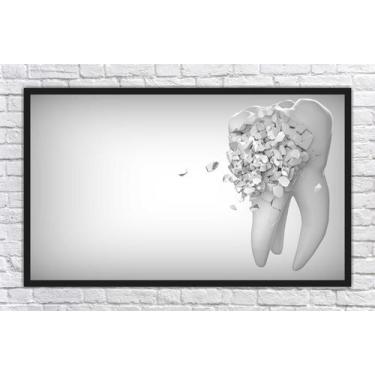 Imagem de Quadro Decorativo Consultórios Odontologia Dentista Dentes Sorriso Est