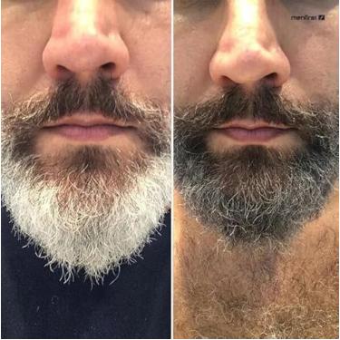 Imagem de 1 Shampoo Escurecedor de Cabelo Brancos | Menfirst" castanho