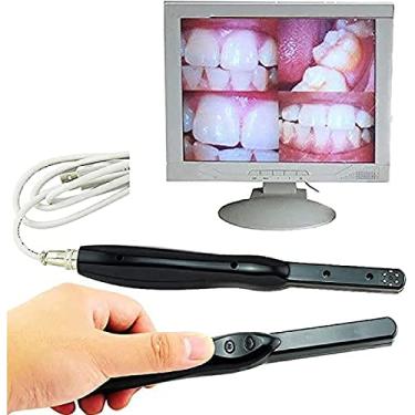 Imagem de Câmera Intraoral Odontológica, HD USBCâmera Intraoral Odontológica Sem Fio, 6 Megapixels, Imagem Clara De 6 LEDs, Para Inspeção Oral De Indivíduos E Animais De Estimação, Dentes Ortodônticos, Saúd