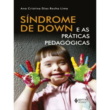 Imagem de Síndrome De Down E As Práticas Pedagógicas