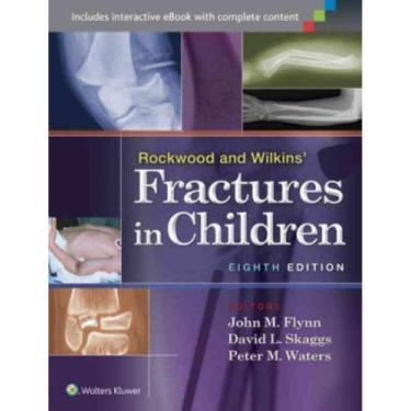 Imagem de Livro - Rockwood & wilkins fractures in children