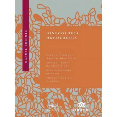 Imagem de Manual Sogimig - Ginecologia Oncológica - MEDBOOK EDITORA, Sortido