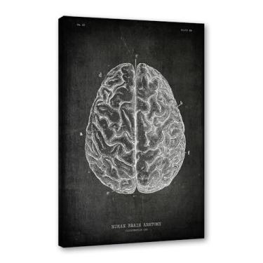 Imagem de Arte vintage de anatomia humana – pintura em tela de educação médica esqueleto humano gaiola cérebro coração anatomia pôster para decoração de casa de clínica hospitalar (SKU3,20.3x30.5 cm = (20x30 cm