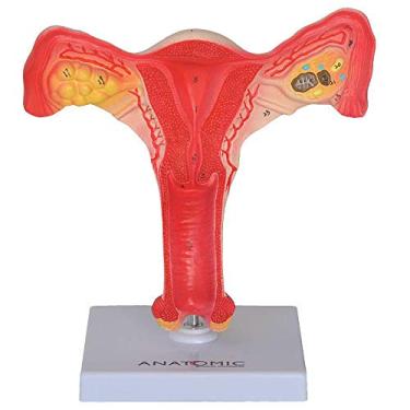 Imagem de Útero c/Trompas Modelo Anatômico