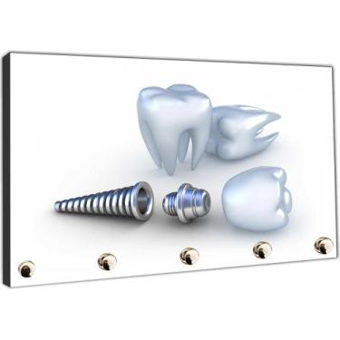Imagem de Porta Chave Dentista Dente Consultórios Sorriso Implante Organizador C