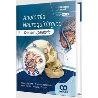 Imagem de Anatomia Neuroquirurgica Craneal Operatoria