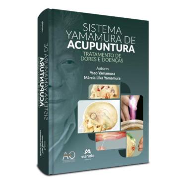 Imagem de Sistema Yamamura De Acupuntura