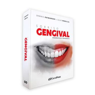 Imagem de Sorriso Gengival - Diagnóstico E Tratamento - Dental Press