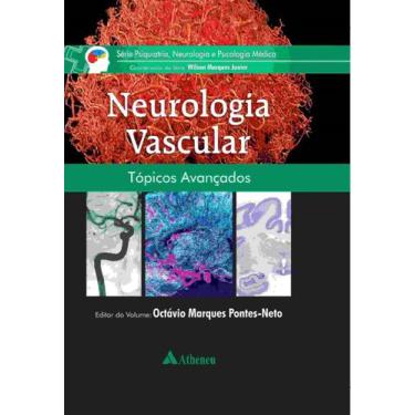 Imagem de Neurologia Vascular + Marca Página