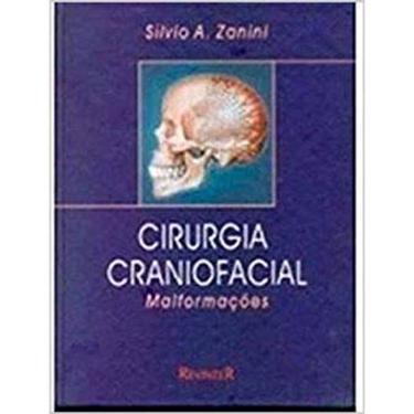 Imagem de Cirurgia Craniofacial. Malformações