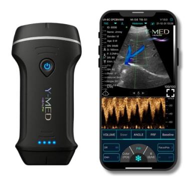 Imagem de Ultrassom Portátil Y-Med PRO BLACK+ 3 em 1, Sonda Convexa Linear Setorial Cardíaco, Doppler Color, 5G/Wi-fi, App Gratuito Ilimitado, Garantia de 2 Anos e Assistência Técnica.
