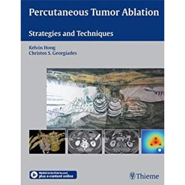 Imagem de Percutaneous Tumor Ablation: Strategies and Techniques