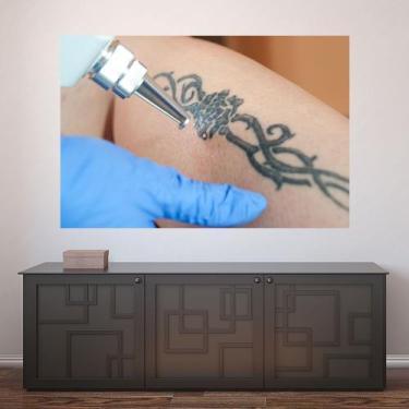 Imagem de Painel Adesivo de Parede - Remoção de Tatuagem - 1200pnp - Allodi