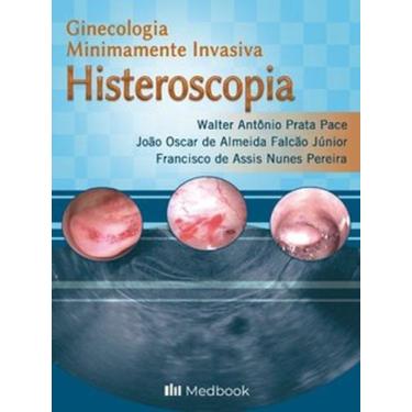 Imagem de Histeroscopia - Ginecologia minimamente invasiva - MEDBOOK, 3