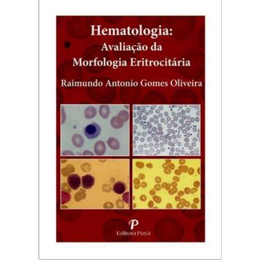 Imagem de Hematologia - Avaliacao Da Morfologia Eritrocitaria - Pranchas