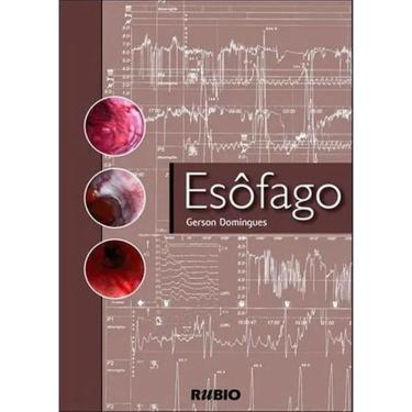 Imagem de Livro: Esôfago Medicina, Anatomia E Fisiologia