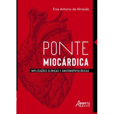 Imagem de Livro - Ponte miocárdica