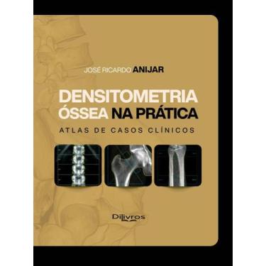 Imagem de Densitometria ssea Na Prática: Atlas De Casos Clínicos - DI LIVROS EDI