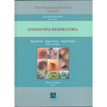 Imagem de Livro - Endoscopia Respiratória