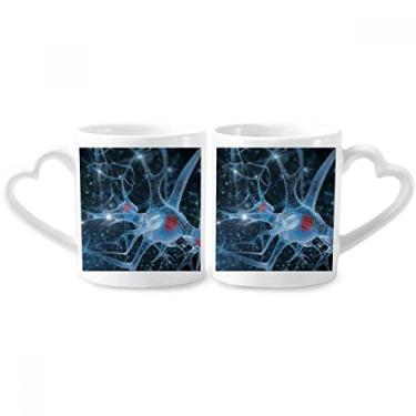 Imagem de Brain Cell Picture Details Pattern Couple Porcelain Mug Set Ceramic Lover Cup Heart Handle