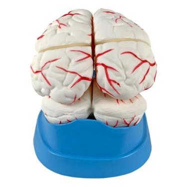 Imagem de Cerebro com Arterias em 8 Partes - Anatomic TGD-0303