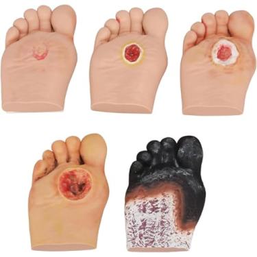 Imagem de Modelo de cuidados com pés diabéticos, lesões purulentas grau 1-5 modelo de simulador de pé diabético para anatomia, fisiologia, ferramenta de demonstrações de cuidados com feridas.