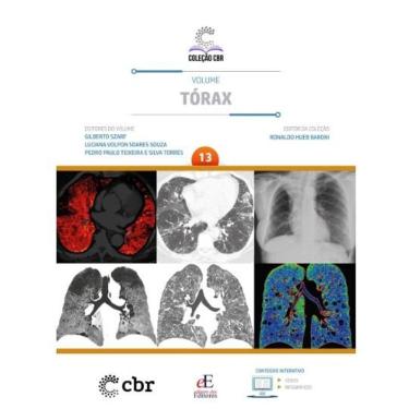 Imagem de Coleção CBR Volume 13: Tórax