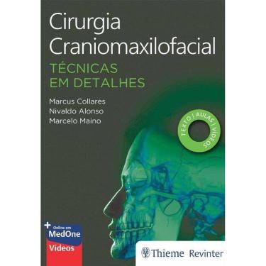 Imagem de Cirurgia Craniomaxilofacial Tecnicas Em Detalhes